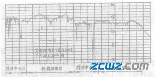 滾子軸承打滑蹭傷因素及軸承防滑措施